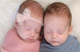 معجزة حقيقية.. أبطالها توأمان ولدا في الشهر السادس