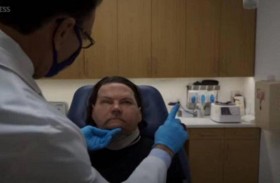 صاحب الوجه واليدين المزروعين يكشف ما يشعر به