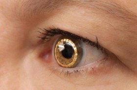 يتهم زوجته بزراعة عدسات تجسس 