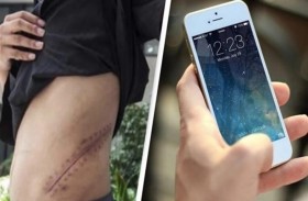 باع كليته لشراء آي فون... فخسر الثانية