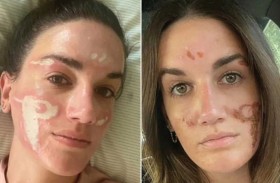 خبيرة تجميل تشوه وجه فتاة أثناء العلاج 