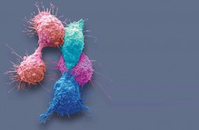 اكتشاف مادة يمكن أن تمنع تكرار الإصابة بالسرطان