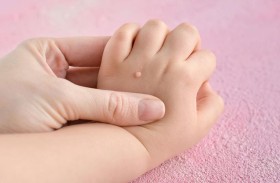 طبيبة تحذر من خطر الثآليل عند الأطفال