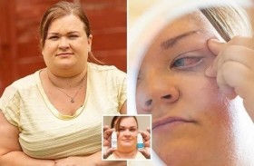 تغلق عينها بعدما وضعت صمغ الأظافر بدلاً من القطرة