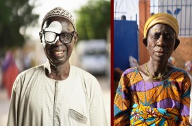 33 مليون مستفيد من برامج نور دبي لمكافحة العمى محليا و عالميا