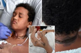 صعق كهربائي يحرق طفلاً أثناء نومه