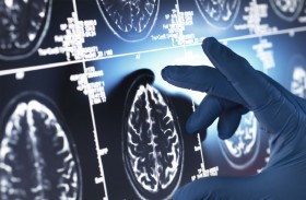 اختراق طبي.. اختبار بسيط يمكنه التنبؤ بسرعة تطور ألزهايمر