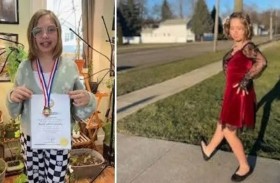 تحقق رقماً قياسياً بعد التنمر على قدميها