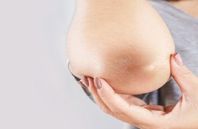 إلى ماذا يشير اسمرار الجلد في منطقة االمرفقين؟