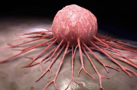 طريقة لتخفيض خطر الإصابة بالسرطان