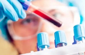 فحص سريع يكتشف أمراض السرطان 