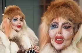 388 عملية تجميل و8 سنوات بلا طعام.. لـ بلوغر شهيرة 