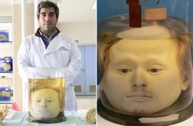 حفظ رأس أسوأ القتلة المتسلسلين في أوروبا