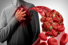 أربع علامات لتجلط الدم يجب  ألا تتجاهلها على الإطلاق