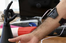 تونسيون يطورون يداً صناعية بالطباعة الثلاثية الأبعاد