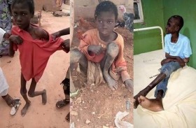 طفل يعيش مربوطاً في حظيرة حيوانات لعامين