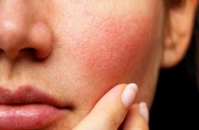 هل يصعب التعامل مع البشرة الحساسة؟