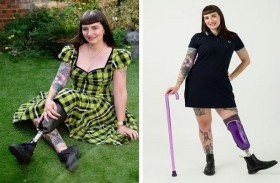 تصبح عارضة أزياء بعد بتر ساقها