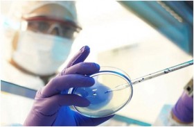 ما هي الفطريات الخضراء؟ .. الأعراض المبكرة للمرض!