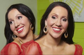 توأم أسترالي يتشارك كل شيء حتى «الحبيب»