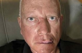 مراهق ينهال بالضرب على عجوز 