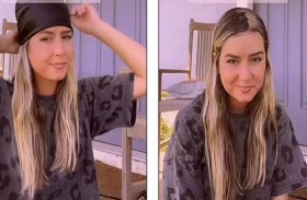 تفقد شعرها بعد التوقف عن حبوب منع الحمل