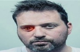 يفقد بصره في عينه فيحولها إلى كاميرا 