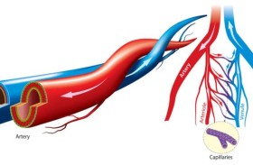 البلاستيك المتراكم في الشرايين.. ماذا يفعل؟