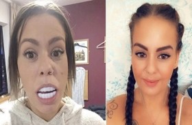 اشترت أسناناً صناعية من أمازون.. وهذا ما حصلت عليه!