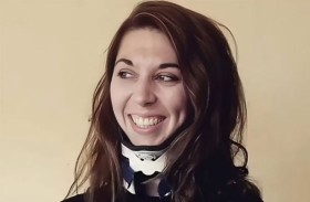 جراحة نادرة تنقذ امرأة بعد انفصال جمجمتها عن عمودها الفقري