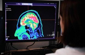 ماذا نعرف عن المرض الغامض متلازمة هافانا؟