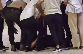 رجل ينهش أنف آخر ويُصيبه بتشوه دائم!