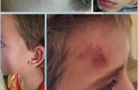 لبنانية تعتدي على طفل سوري بوحشية