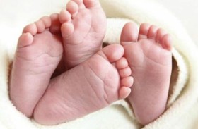 حالة نادرة جداً... لتوأم عنكبوتي    