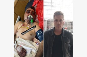 سائق تاكسي ضحية ملاكم أغضبته الأجرة 