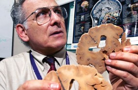 دراسة : الليثيوم يحمي من الزهايمر وتراجع الذاكرة