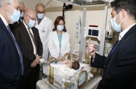 نجاح عملية فصل توأم سيامي