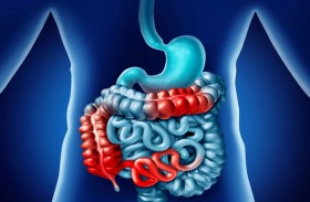 اكتشاف جديد عن السبب الحقيقي وراء التهاب القولون المزمن