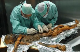 دراسة: رجل الثلج أوتزي كان أصلع و ببشرة داكنة 