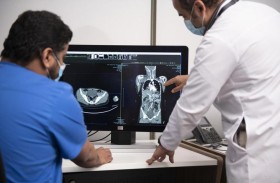 فرق تدخل سريع لمعالجة الجلطات الدماغية وتحليل الأشعة خلال 30 دقيقة فقط