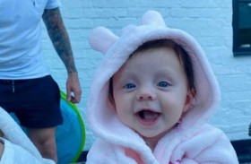 طفلة تتحول إلى حجر بسبب  حالة نادرة