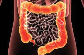 علماء يكتشفون السبب الرئيس لداء الأمعاء الالتهابي