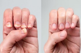 تقارير تكشف عمّا يسمى 