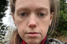 تتقيأ 60 مرة يومياً