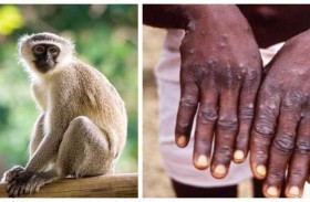 متى يكون المصاب بجدري القرود معديا؟