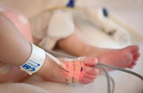 قلب توقف عن النبض ينقذ رضيعة