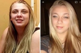 تفقد البصر بعد تصرف متعمد