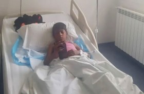 يطلق النار على طفل ويصيبه بسبب ديك