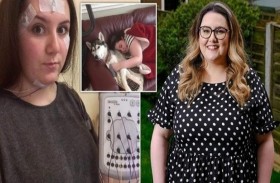 حالة نادرة تجعلها تنام عندما تضحك