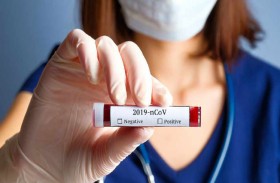 71 إصابة جديدة بكورونا المستجد في بلجيكا